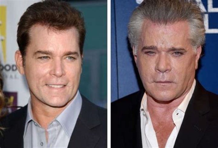 
Has Ray Liotta Done Plastic Surgery And Used Botox And Nose Job 