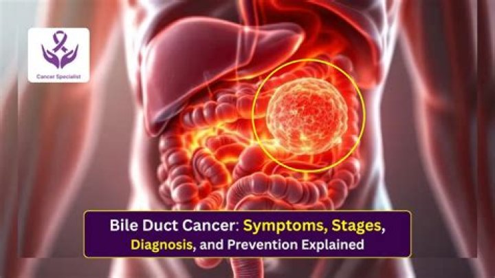 
What Stage Is Maria Barry Cancer Now? Bile Duct Cancer Symptoms Explained 