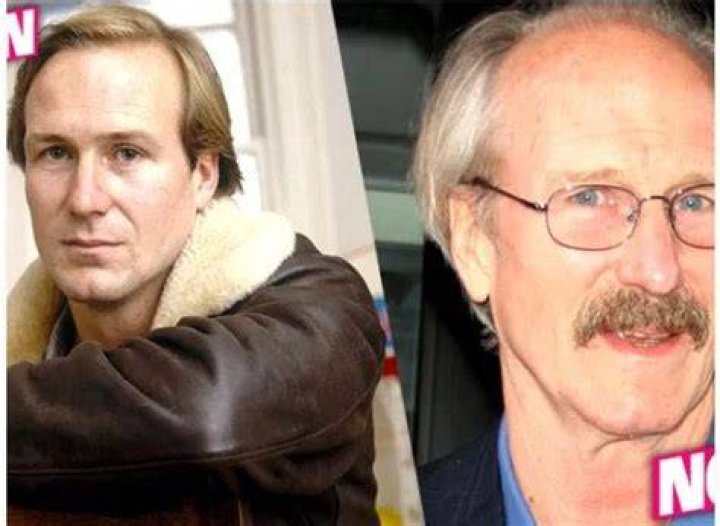 William Hurt cancer and cause of death
